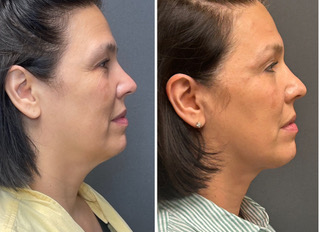 website replacement 4