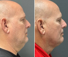 wesbite replacement 2