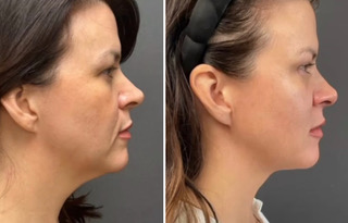 wesbite replacement 3